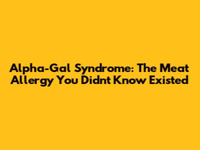 Alpha-Gal Syndrome: The Meat Allergy You Didn't Know Existed