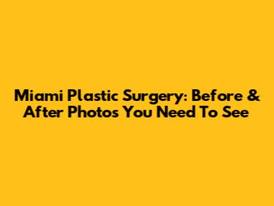 Miami Plastic Surgery: Before & After Photos You Need To See
