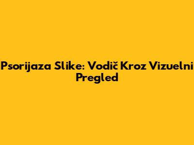 Psorijaza Slike: Vodič Kroz Vizuelni Pregled